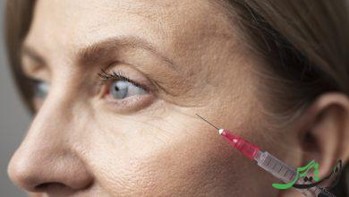 درمان سیاهی و چروک زیر چشم با نانوفت